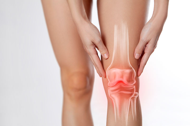 Arthritis in knee joints